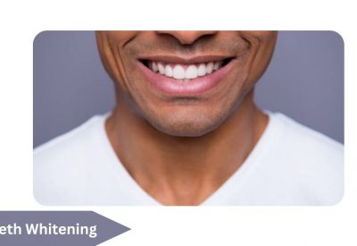 Teeth Whitening