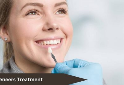 Veneers Treatment
