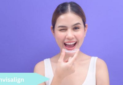 invisalign